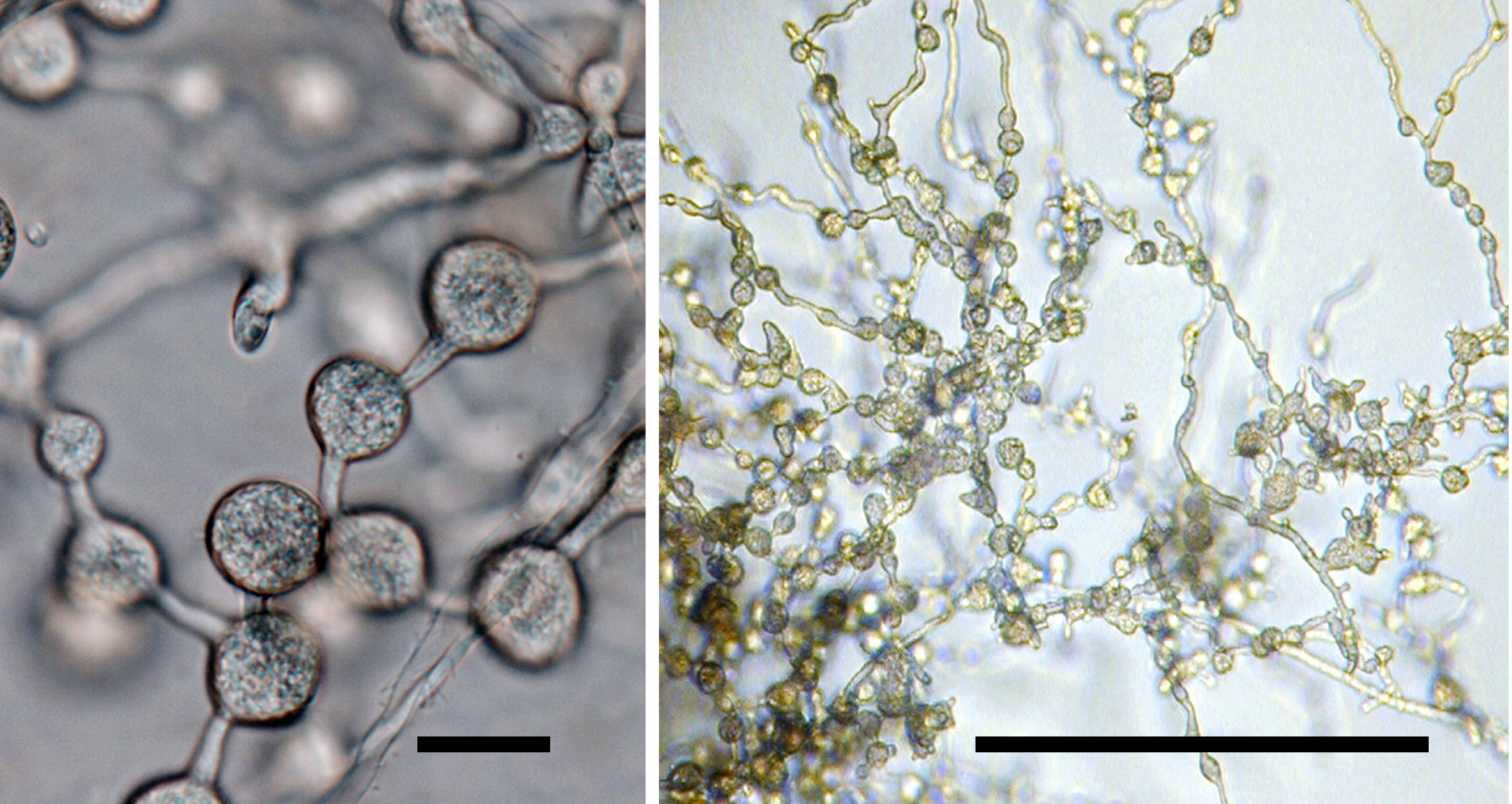  distinctive globose hyphal swellings in chains; scale bar = 20micro;m 
